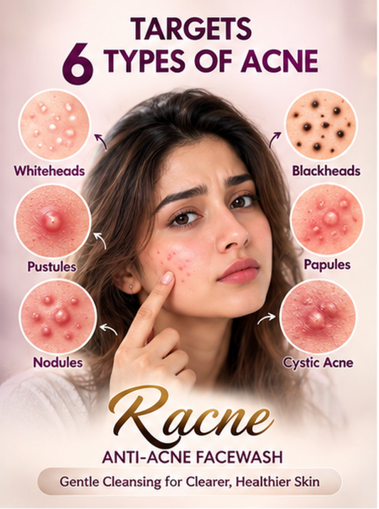 Promotional graphic for Racne Anti-Acne Facewash, showing a woman pointing to her cheek with acne lesions, surrounded by labeled circular diagrams of acne types: Whiteheads, Blackheads, Pustules, Nodules, Papules, and Cystic Acne. Text at the top reads 'TARGETS 6 TYPES OF ACNE' and the bottom text says 'Gentle Cleansing for Clearer, Healthier Skin.